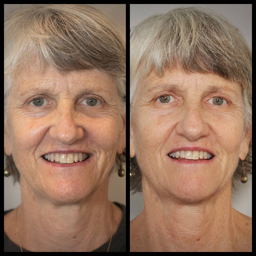 Aureterra Botanical Peptide Cream clinical results on mature skin with improved firmness, brightness, and reduced fine lines