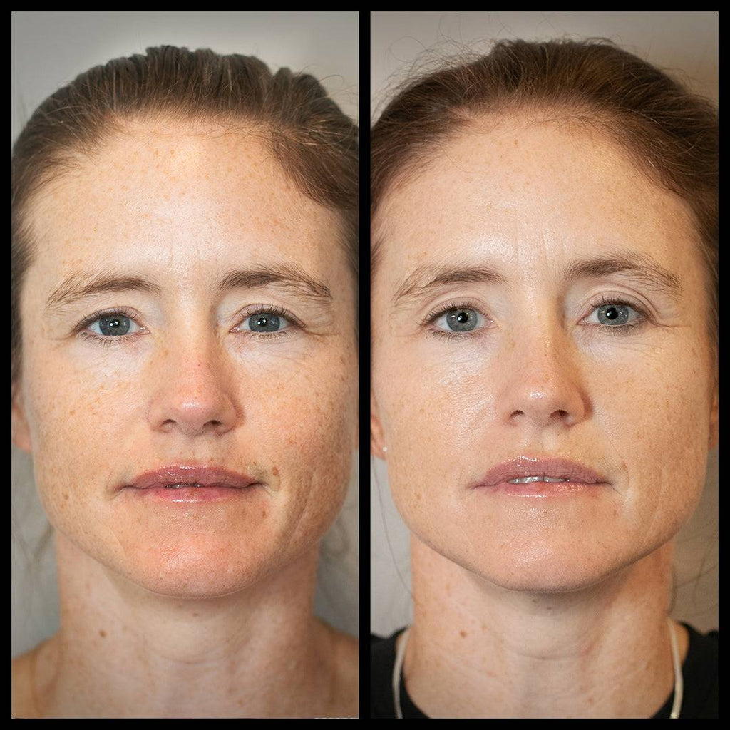Before and after results using Aureterra Botanical Peptide Cream, showing visibly smoother, brighter, more even-toned skin.